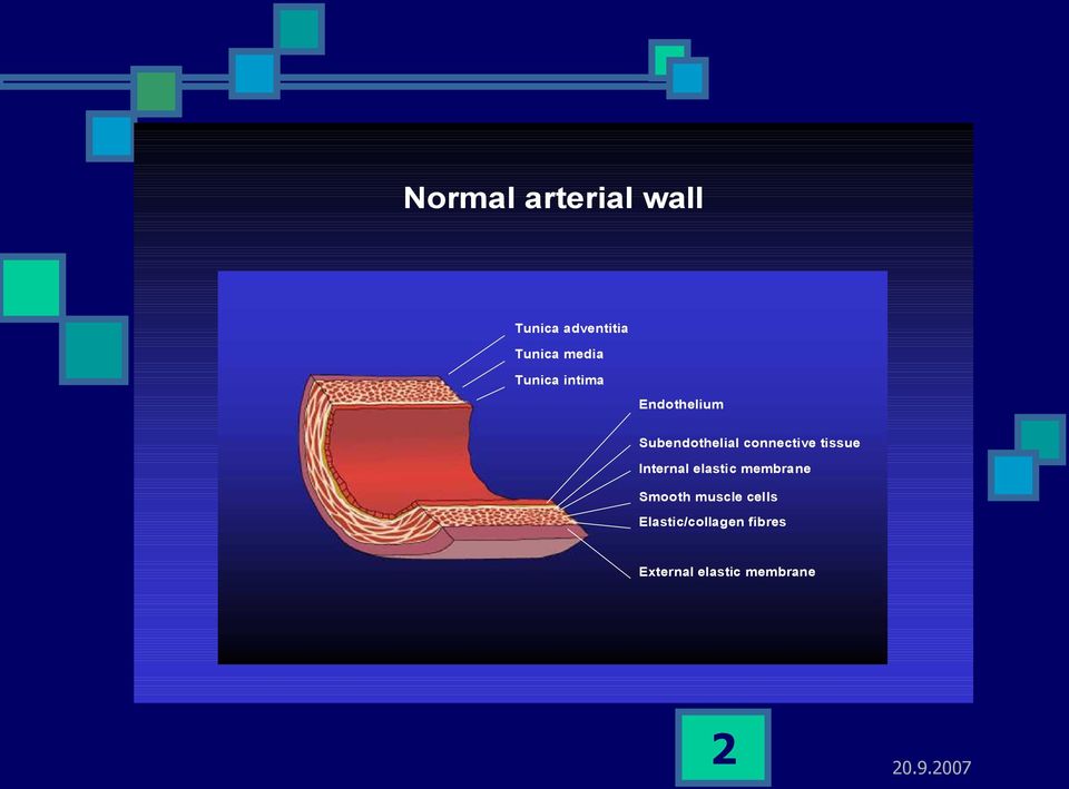 tissue Internal elastic membrane Smooth muscle