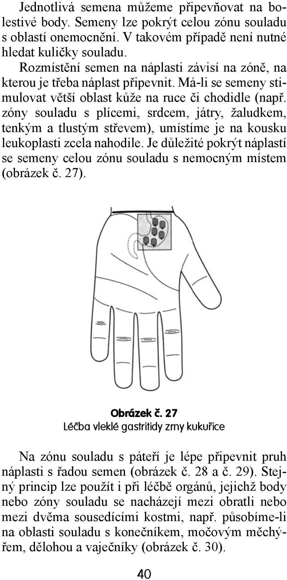 zóny souladu s plícemi, srdcem, játry, žaludkem, tenkým a tlustým střevem), umístíme je na kousku leukoplasti zcela nahodile.