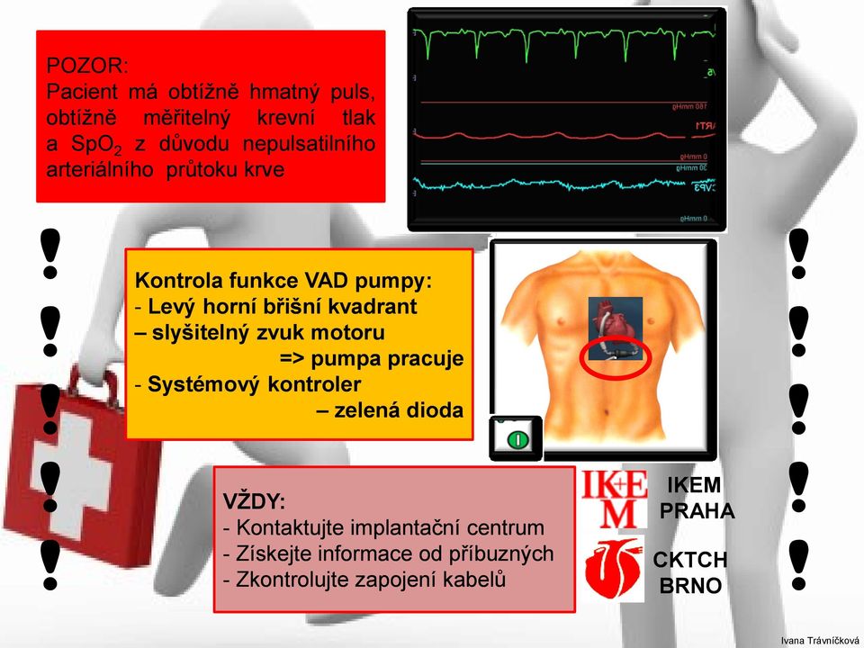 !! Kontrola funkce VAD pumpy: - Levý horní břišní kvadrant slyšitelný zvuk motoru => pumpa pracuje