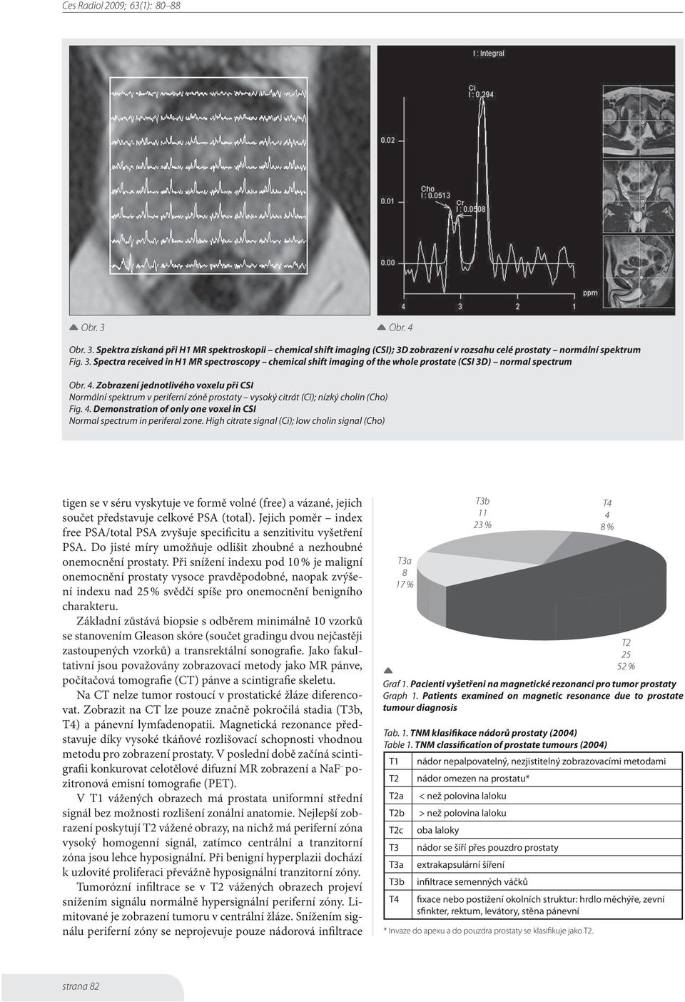 Demonstration of only one voxel in CSI Normal spectrum in periferal zone.