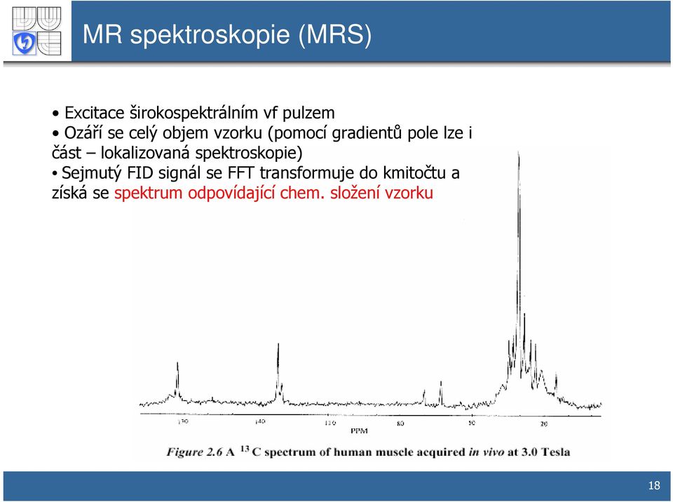 lokalizovaná spektroskopie) Sejmutý FID signál se FFT