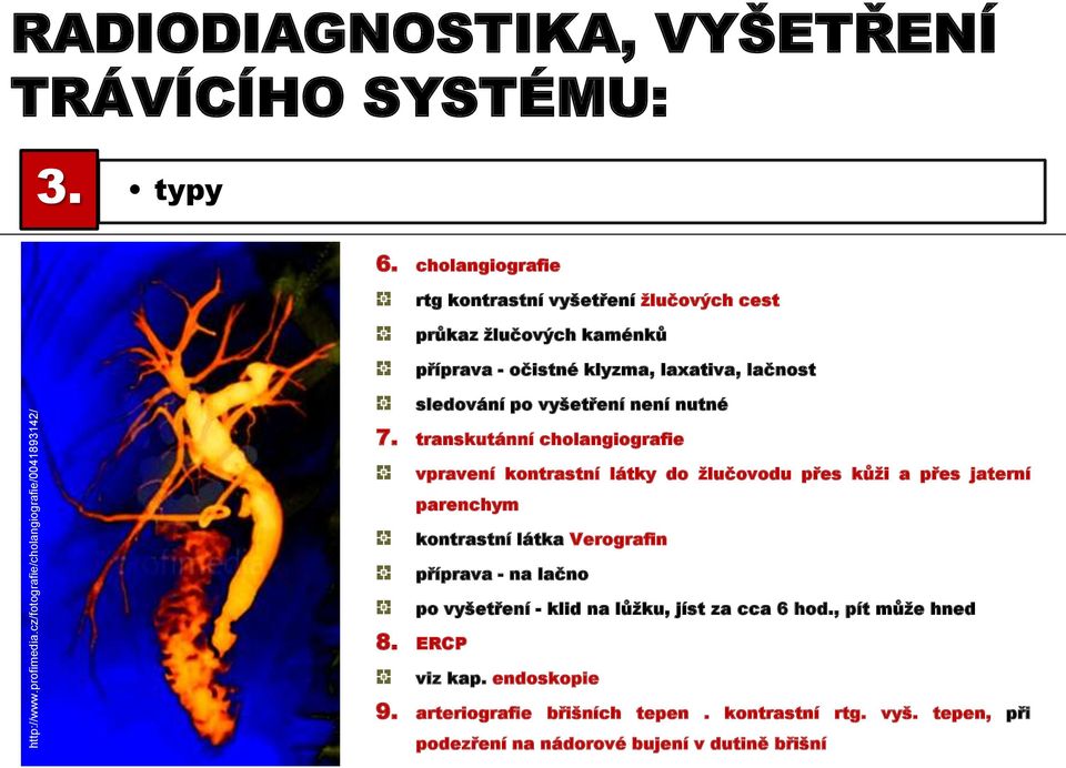 7. transkutánní cholangiografie vpravení kontrastní látky do žlučovodu přes kůži a přes jaterní parenchym kontrastní látka Verografin příprava - na lačno po