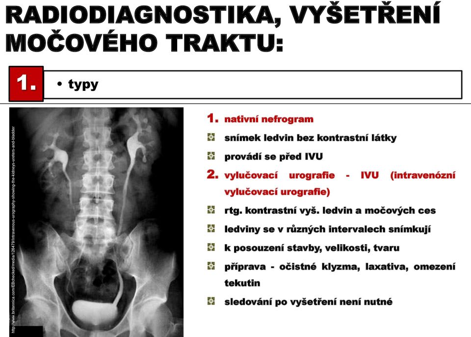 TRAKTU: 1. typy 1. nativní nefrogram snímek ledvin bez kontrastní látky provádí se před IVU 2.