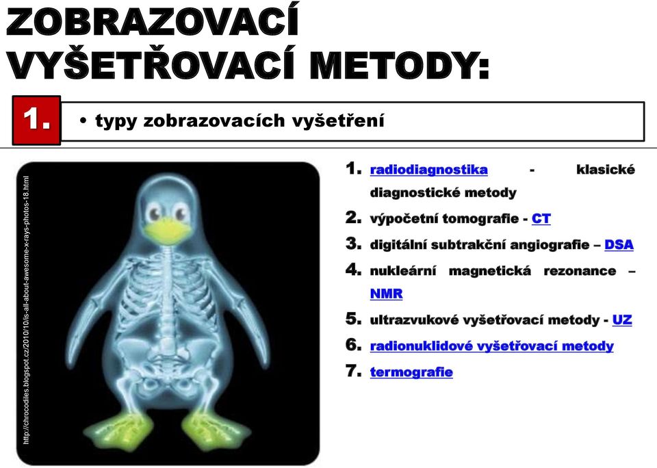 radiodiagnostika - klasické diagnostické metody 2. výpočetní tomografie - CT 3.