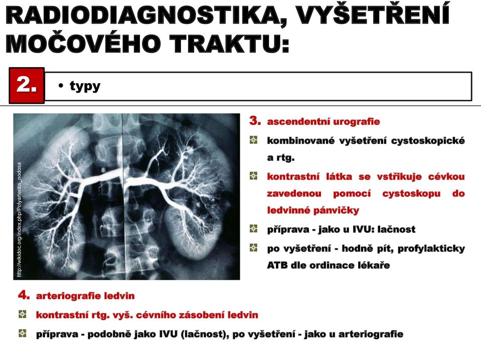 kontrastní látka se vstřikuje cévkou zavedenou pomocí cystoskopu do ledvinné pánvičky příprava - jako u IVU: lačnost po