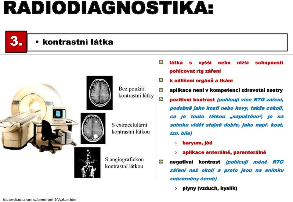 sestry pozitivní kontrast (pohlcují více RTG záření, podobně jako kosti nebo kovy, takže cokoli, co je touto látkou napuštěno, je na snímku