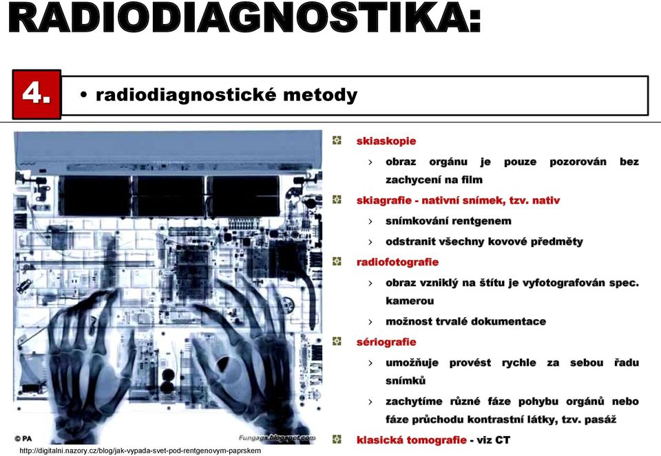 nativ snímkování rentgenem odstranit všechny kovové předměty radiofotografie obraz vzniklý na štítu je vyfotografován spec.