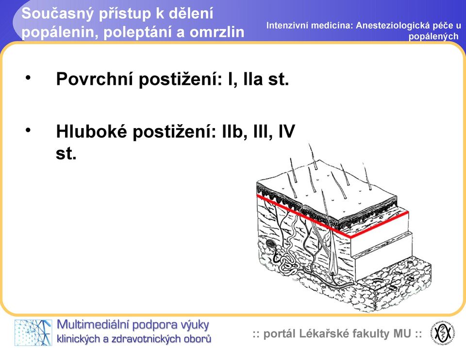 Povrchní postižení: I, IIa st.