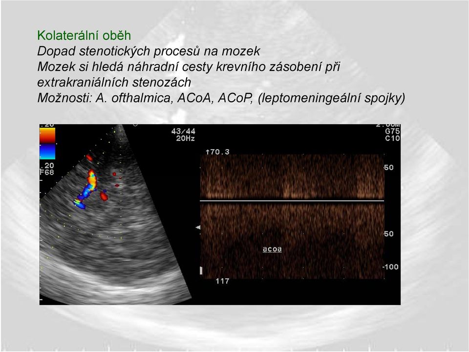 zásobení při extrakraniálních stenozách