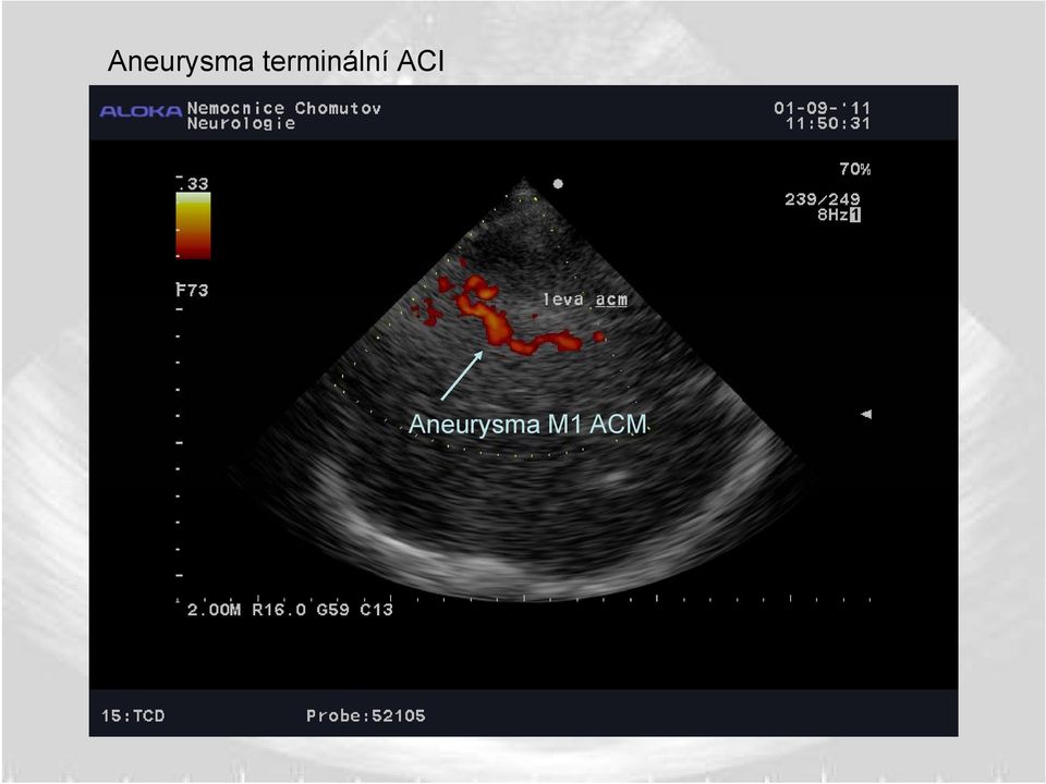 ACI  M1