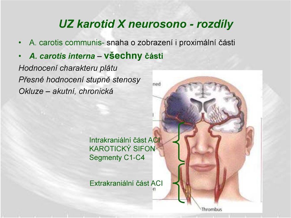 carotis interna všechny části Hodnocení charakteru plátu Přesné hodnocení