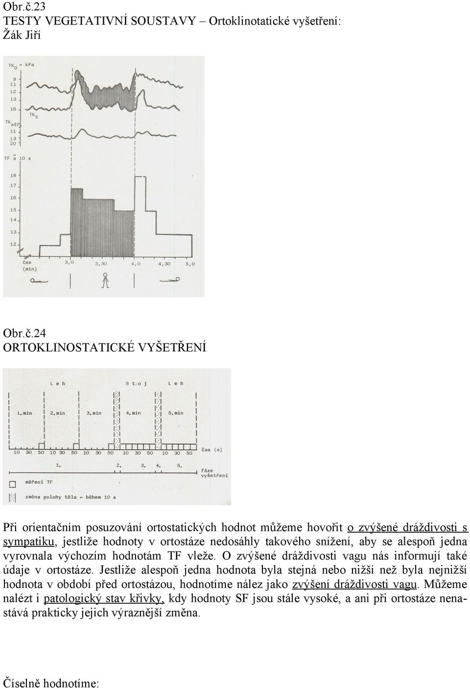 dráždivosti s sympatiku, jestliže hodnoty v ortostáze nedosáhly takového snížení, aby se alespoň jedna vyrovnala výchozím hodnotám TF vleže.