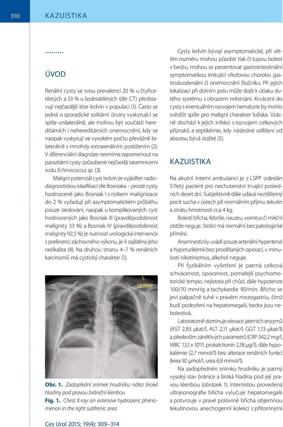 bilaterálně s mnohdy extrarenálním postižením (2). V diferenciální diagnóze nesmíme zapomenout na parazitární cysty způsobené nejčastěji tasemnicemi rodu Echinococcus sp. (3).