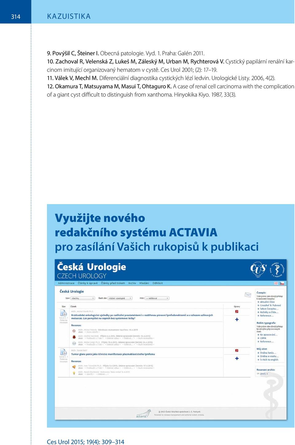 Diferenciální diagnostika cystických lézí ledvin. Urologické Listy. 2006, 4(2). 12. Okamura T, Matsuyama M, Masui T, Ohtaguro K.