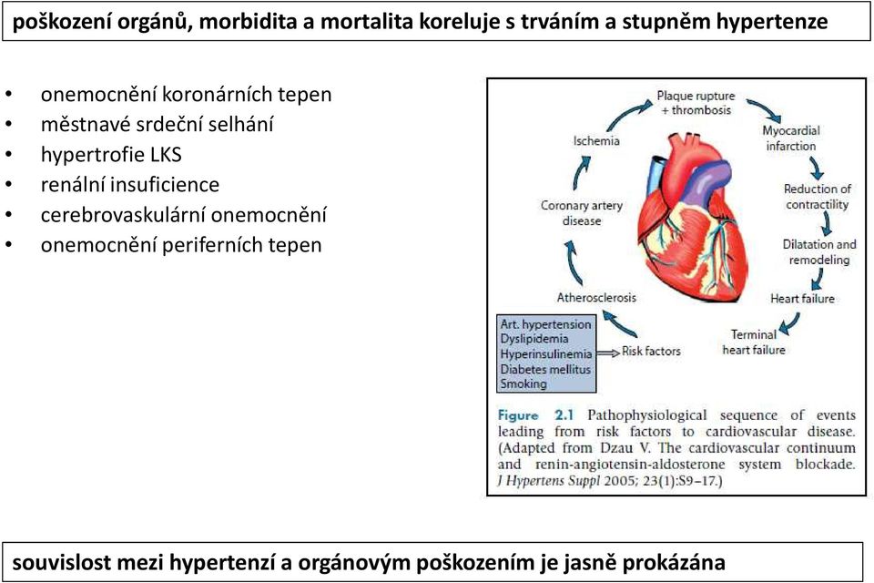 hypertrofie LKS renální insuficience cerebrovaskulární onemocnění