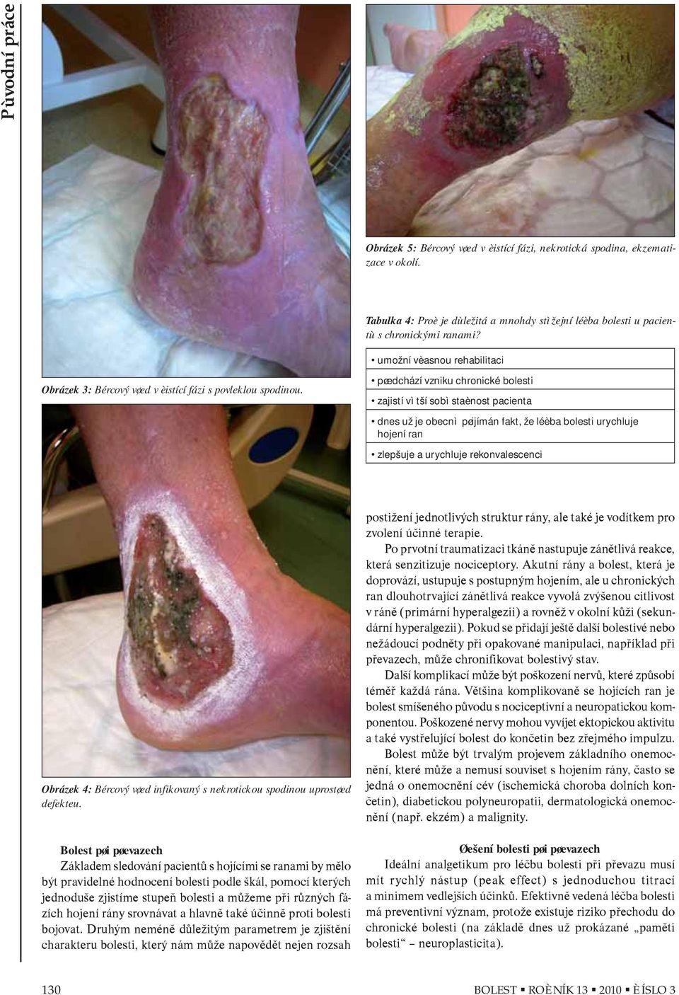 pøedchází vzniku chronické bolesti zajistí vìtší sobìstaènost pacienta dnes už je obecnì pøijímán fakt, že léèba bolesti urychluje hojení ran zlepšuje a urychluje rekonvalescenci Obrázek 4: Bércový