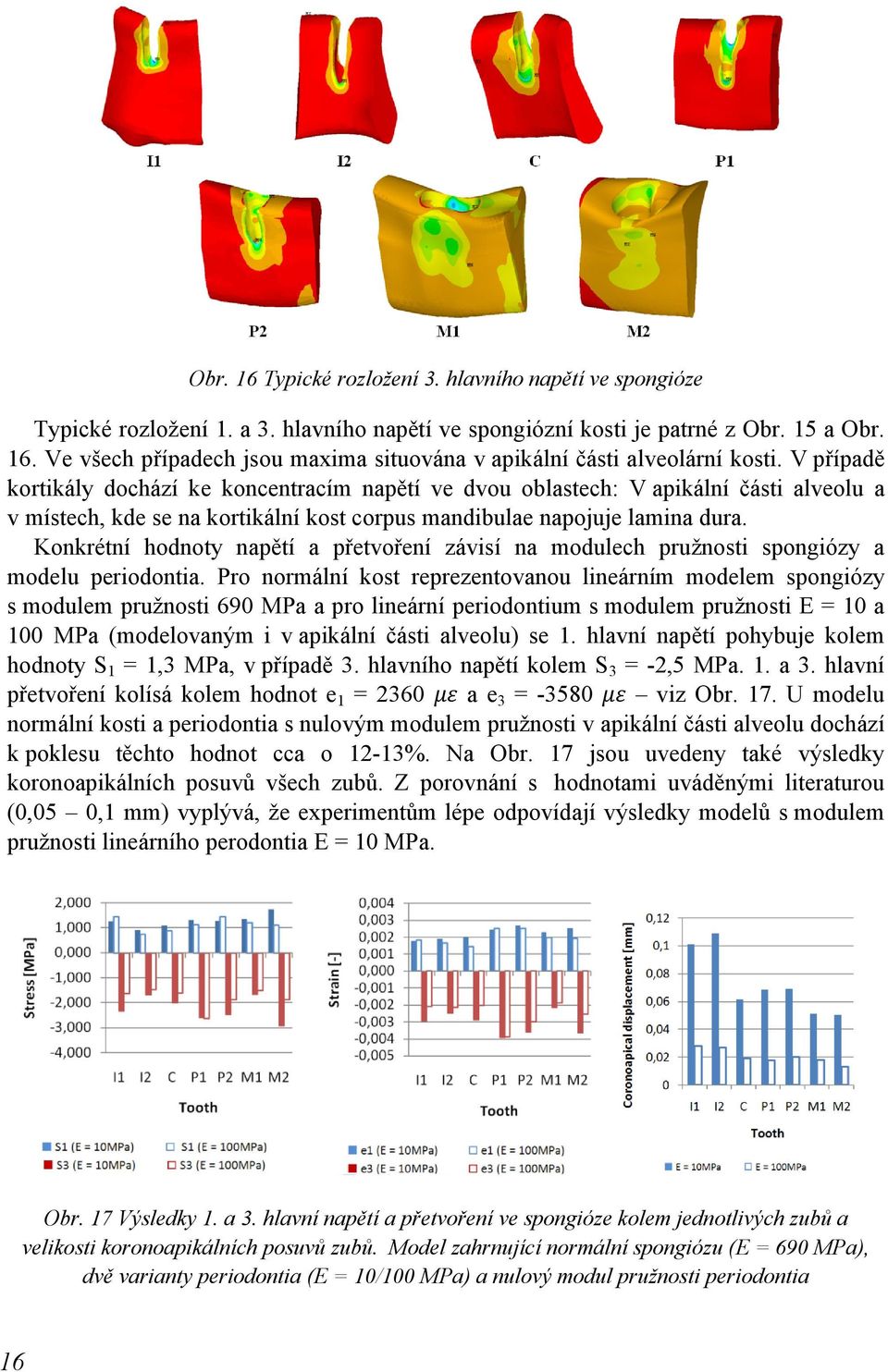 Konkrétní hodnoty napětí a přetvoření závisí na modulech pružnosti spongiózy a modelu periodontia.