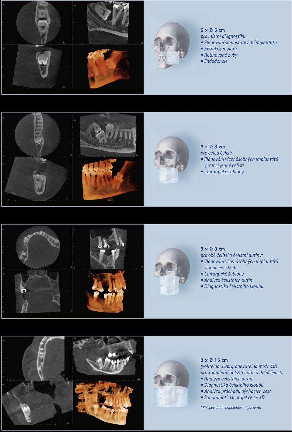 čelistech Chirurgické šablony Analýza čelistních dutin Diagnostika čelistního kloubu 8 Ø 15 cm (volitelná a uprgradovatelná možnost) pro kompletní oblasti