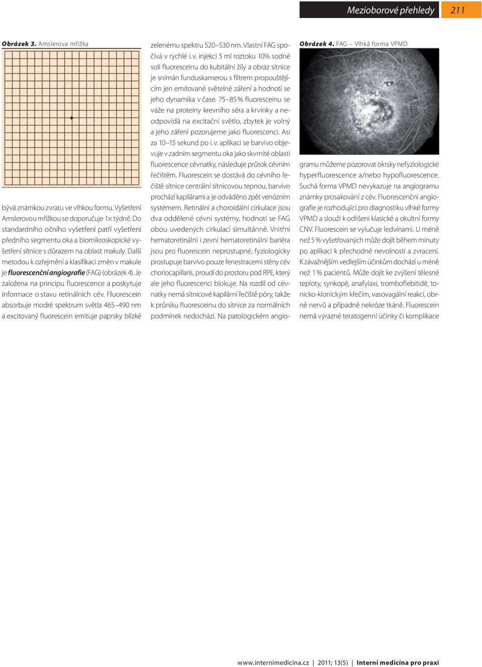 Další metodou k ozřejmění a klasifikaci změn v makule je fluorescenční angiografie (FAG) (obrázek 4). Je založena na principu fluorescence a poskytuje informace o stavu retinálních cév.