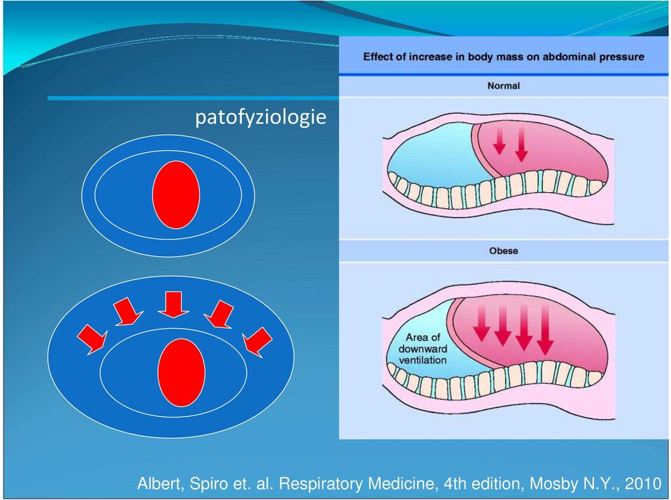 Respiratory Medicine,