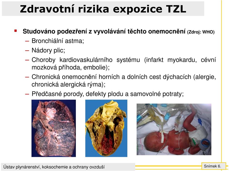 cévní mozková příhoda, embolie); Chronická onemocnění horních a dolních cest dýchacích