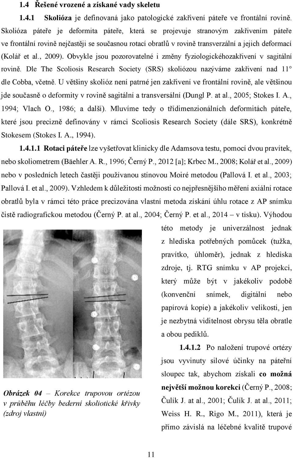 , 2009). Obvykle jsou pozorovatelné i změny fyziologickéhozakřivení v sagitální rovině. Dle The Scoliosis Research Society (SRS) skoliózou nazýváme zakřivení nad 11 dle Cobba, včetně.