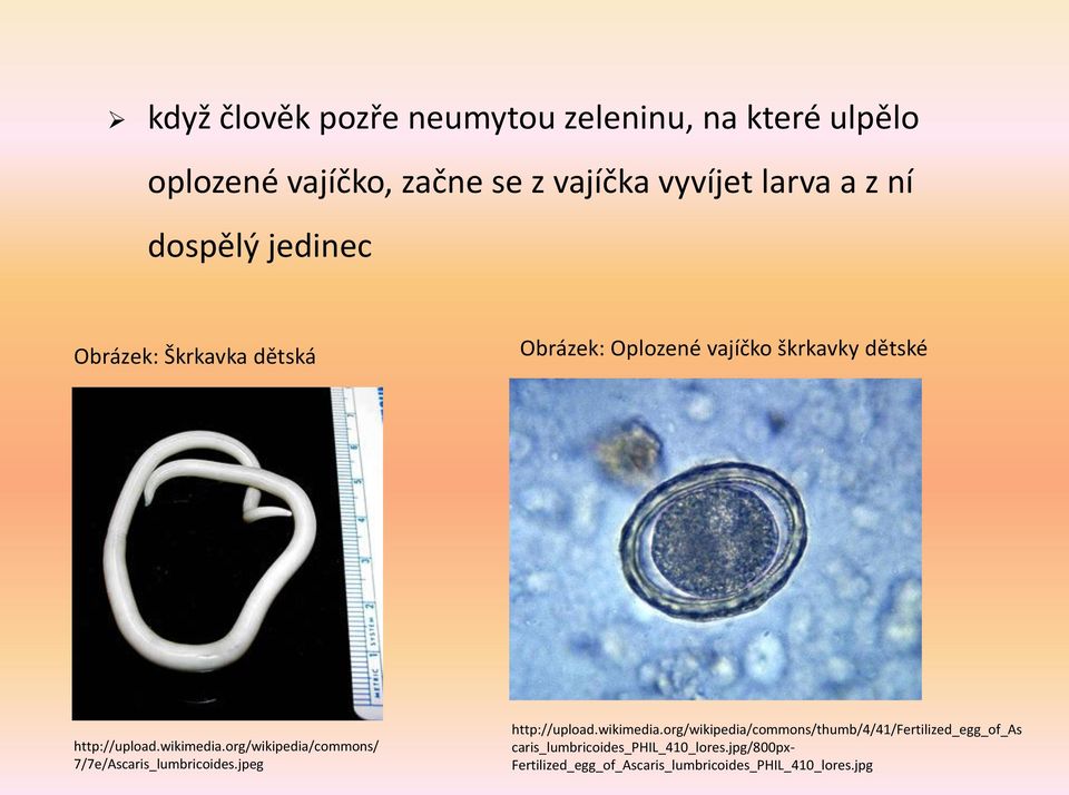 org/wikipedia/commons/ 7/7e/Ascaris_lumbricoides.jpeg http://upload.wikimedia.