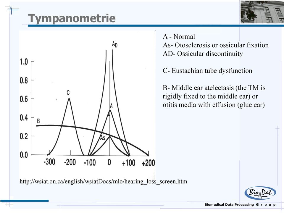 atelectasis (the TM is rigidly fixed to the middle ear) or otitis media