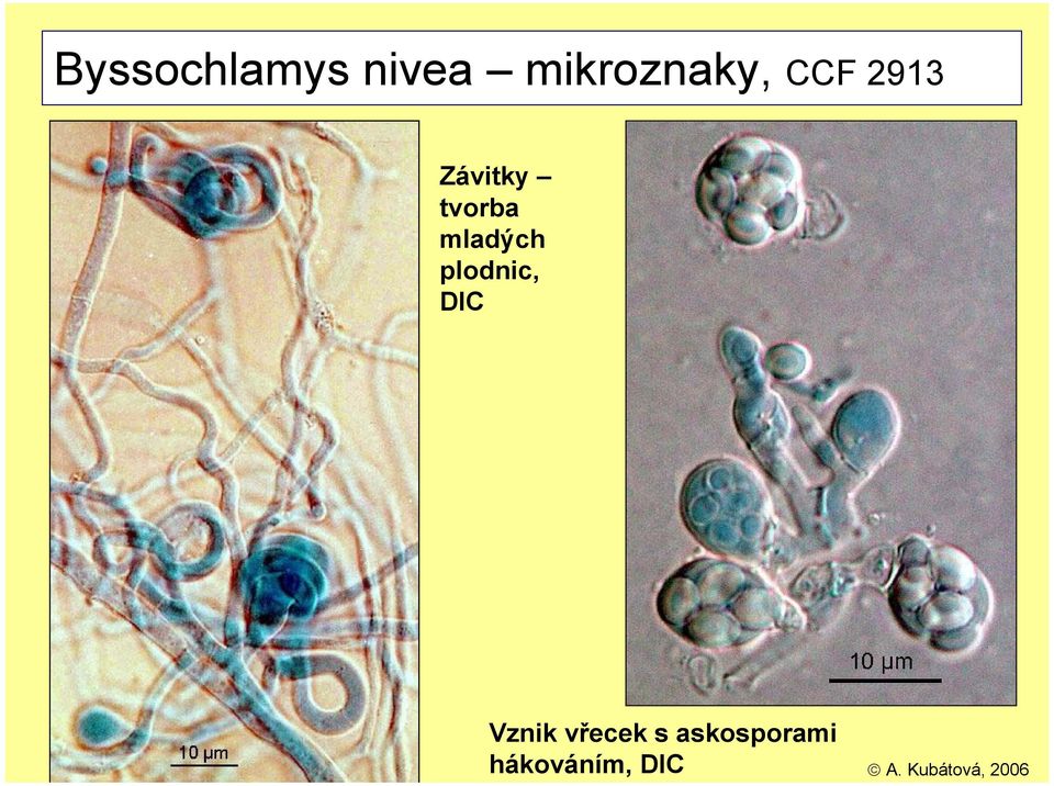 nivea mikroznaky, CCF 2913