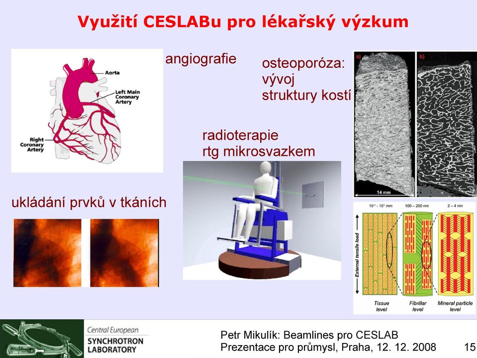 vývoj struktury kostí radioterapie