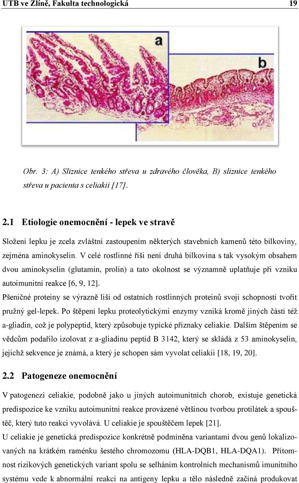 V celé rostlinné říši není druhá bílkovina s tak vysokým obsahem dvou aminokyselin (glutamin, prolin) a tato okolnost se významně uplatňuje při vzniku autoimunitní reakce [6, 9, 12].