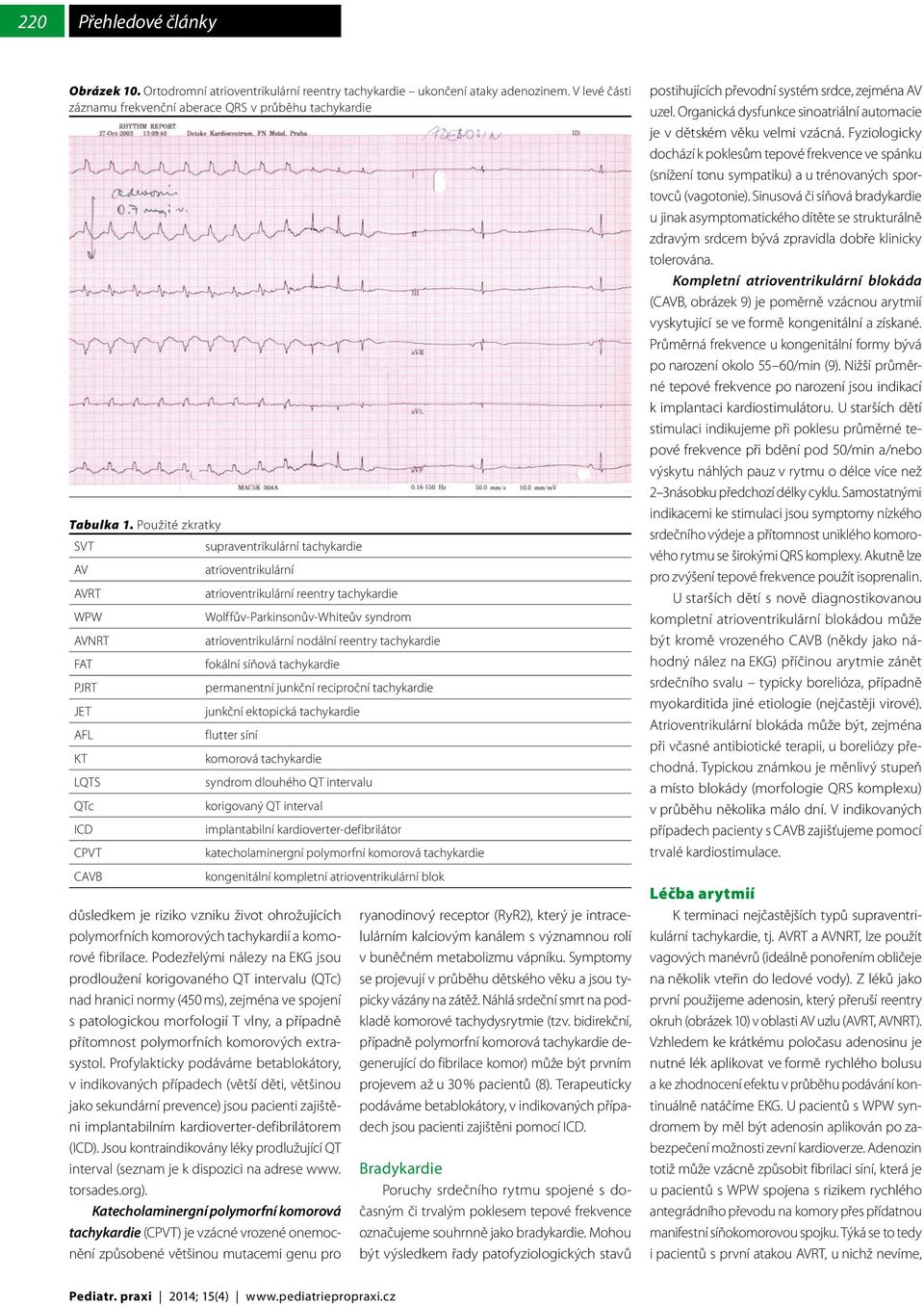 tachykardie FAT fokální síňová tachykardie PJRT permanentní junkční reciproční tachykardie JET junkční ektopická tachykardie AFL flutter síní KT komorová tachykardie LQTS syndrom dlouhého QT