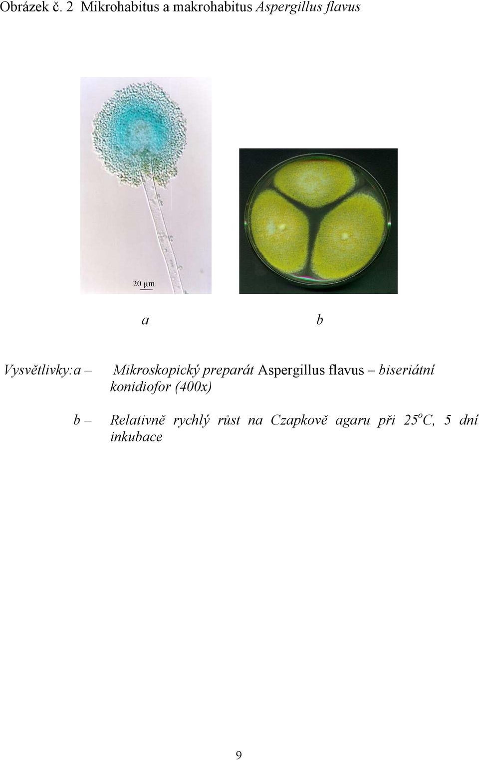 b Vysvětlivky:a b Mikroskopický preparát Aspergillus