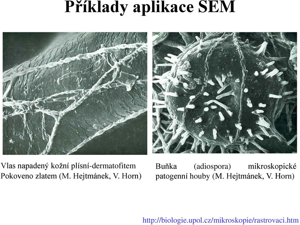 Horn) Buňka (adiospora) mikroskopické patogenní houby