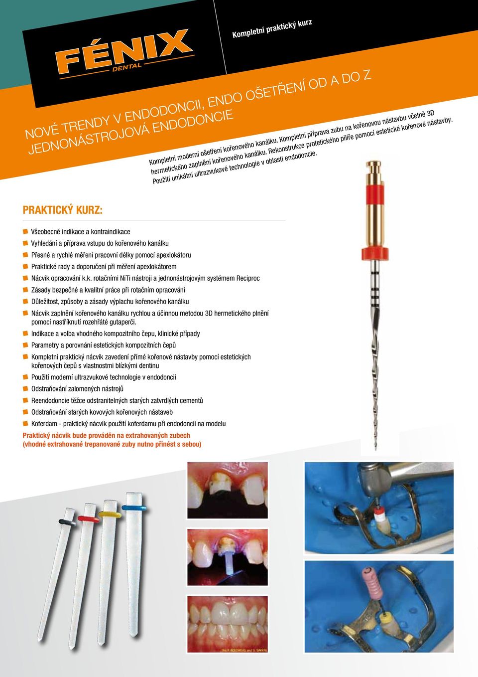 Použití unikátní ultrazvukové technologie v oblasti endodoncie.