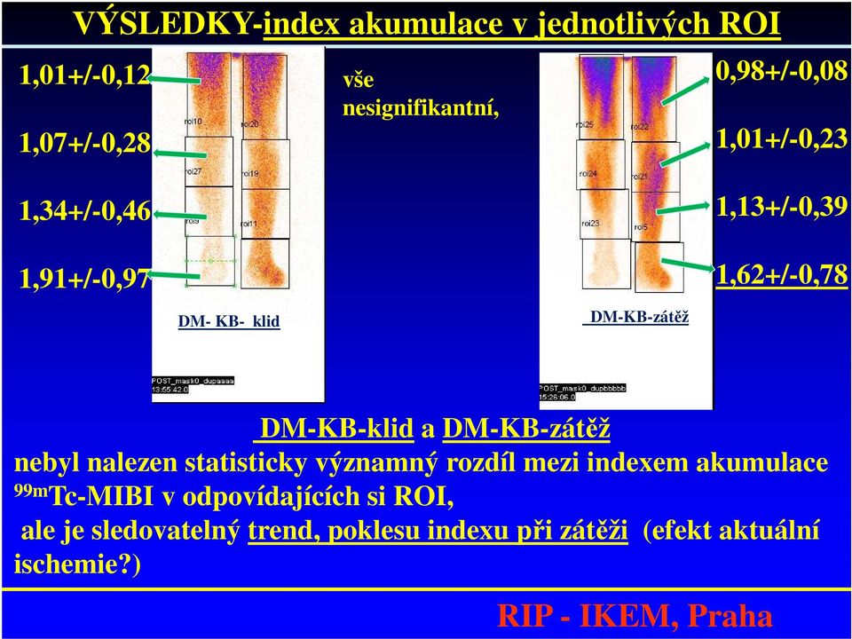 DM-KB-zátěž DM-KB-klid a DM-KB-zátěž nebyl nalezen statisticky významný rozdíl mezi indexem