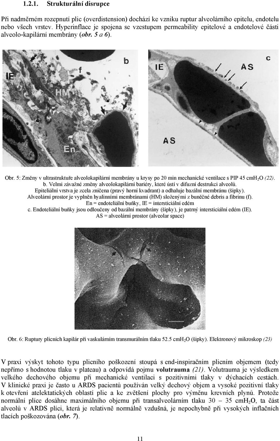 5: Změny v ultrastruktuře alveolokapilární membrány u krysy po 20 min mechanické ventilace s PIP 45 cmh 2 O (22). b.