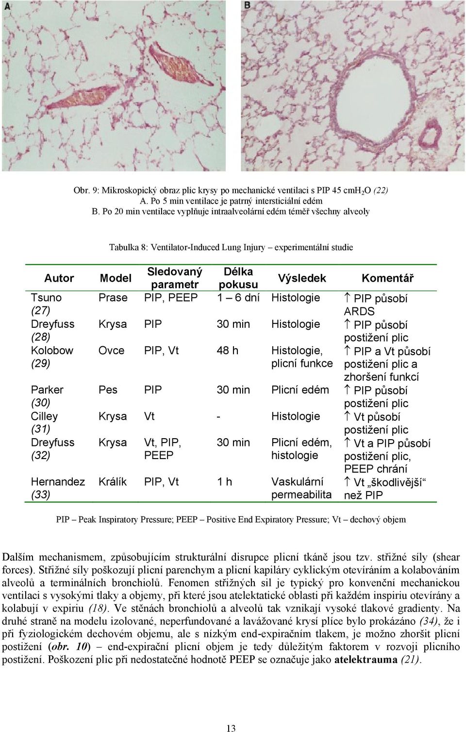 (31) Dreyfuss (32) Hernandez (33) Model Sledovaný Délka parametr pokusu Výsledek Komentář Prase PIP, PEEP 1 6 dní Histologie PIP působí ARDS Krysa PIP 30 min Histologie PIP působí postižení plic Ovce