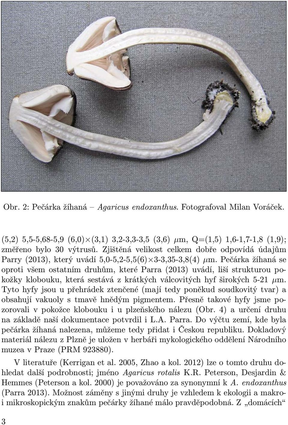 Pečárka žíhaná se oproti všem ostatním druhům, které Parra (2013) uvádí, liší strukturou pokožky klobouku, která sestává z krátkých válcovitých hyf širokých 5-21 µm.