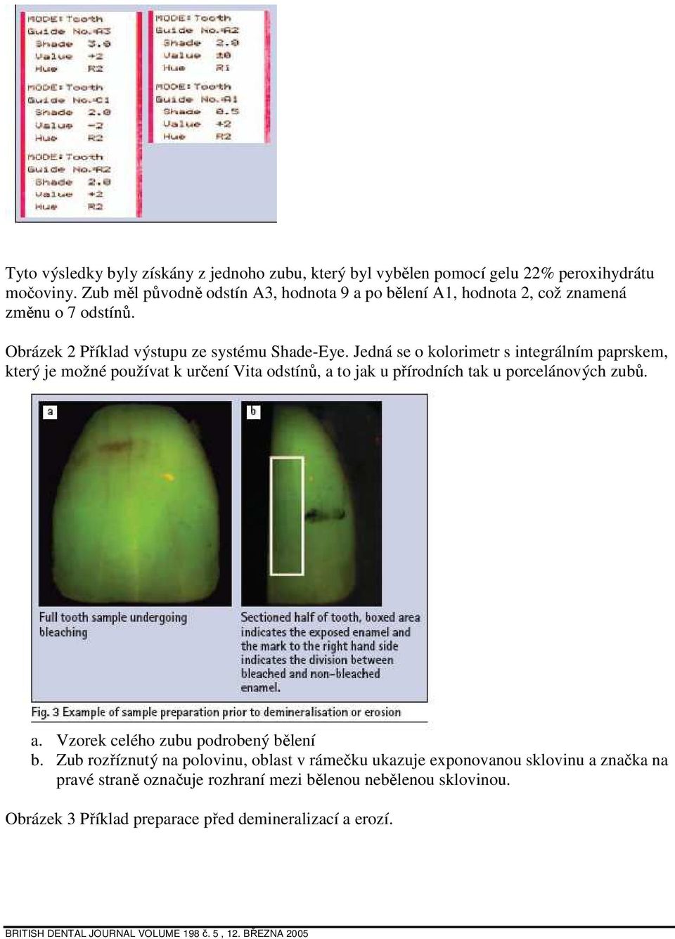 Jedná se o kolorimetr s integrálním paprskem, který je možné používat k určení Vita odstínů, a to jak u přírodních tak u porcelánových zubů. a. Vzorek celého zubu podrobený bělení b.