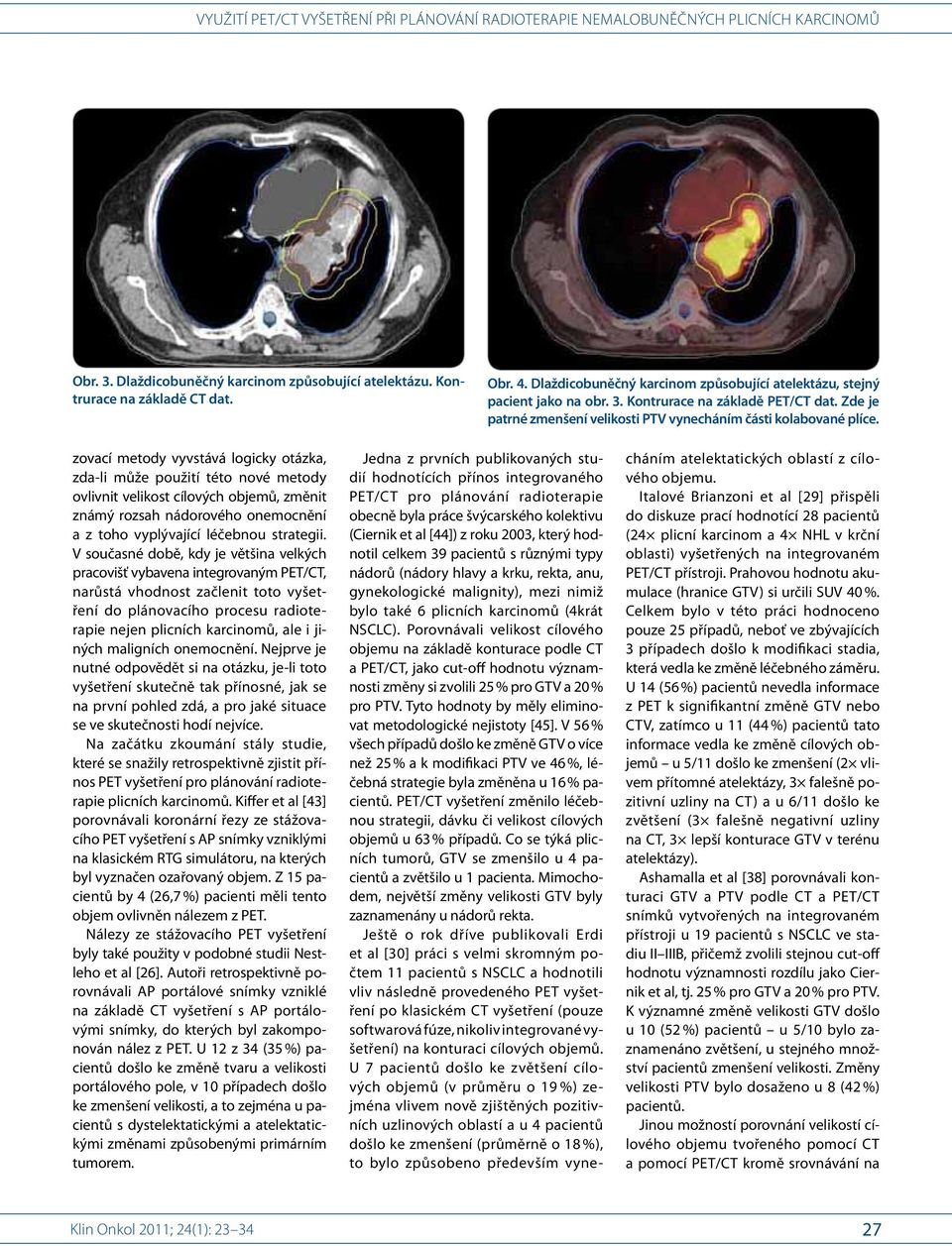 Jedna z prvních publikovaných studií hodnotících přínos integrovaného PET/CT pro plánování radioterapie obecně byla práce švýcarského kolektivu (Ciernik et al [44]) z roku 2003, který hodnotil celkem