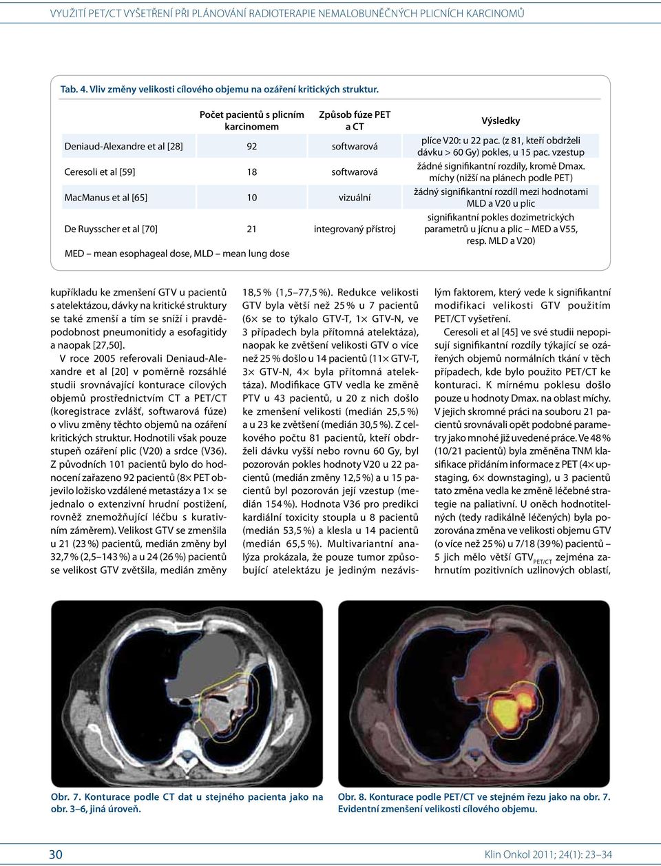 integrovaný přístroj MED mean esophageal dose, MLD mean lung dose Výsledky plíce V20: u 22 pac. (z 81, kteří obdrželi dávku > 60 Gy) pokles, u 15 pac. vzestup žádné signifikantní rozdíly, kromě Dmax.