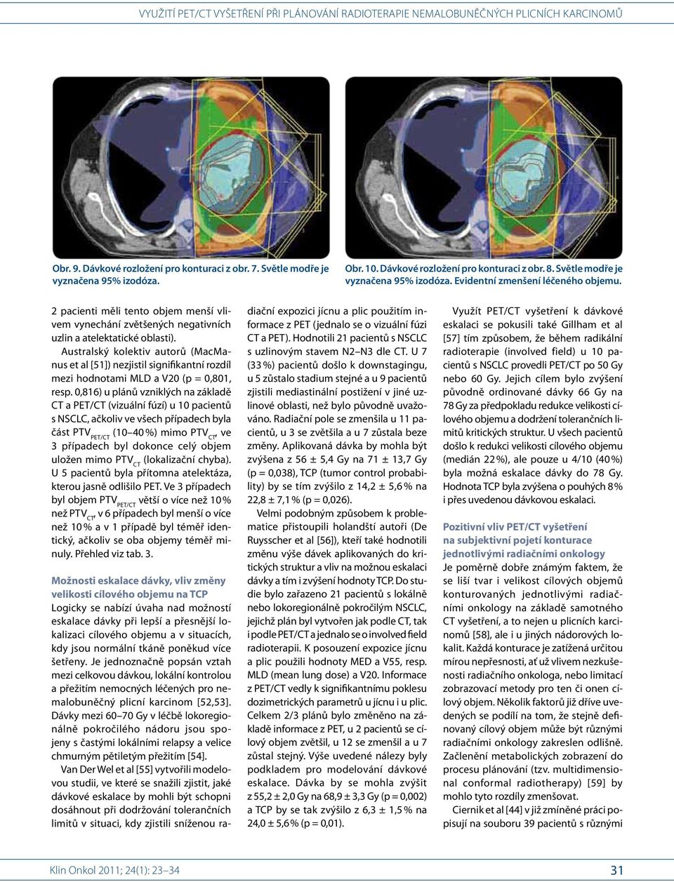 Australský kolektiv autorů (MacManus et al [51]) nezjistil signifikantní rozdíl mezi hodnotami MLD a V20 (p = 0,801, resp.