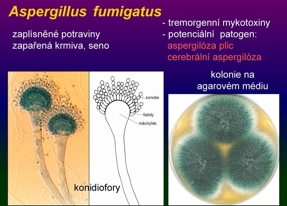 - potenciální patogen: aspergilóza plic