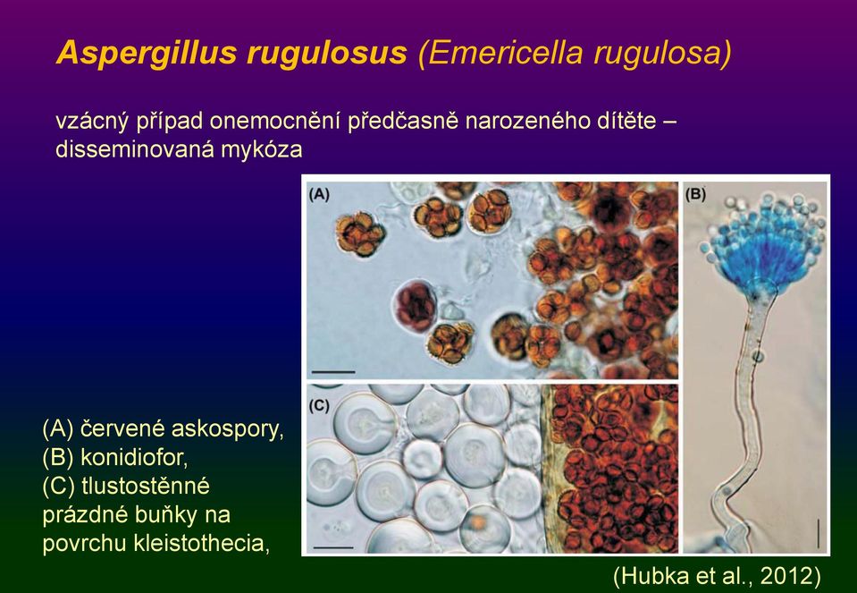 mykóza (A) červené askospory, (B) konidiofor, (C)