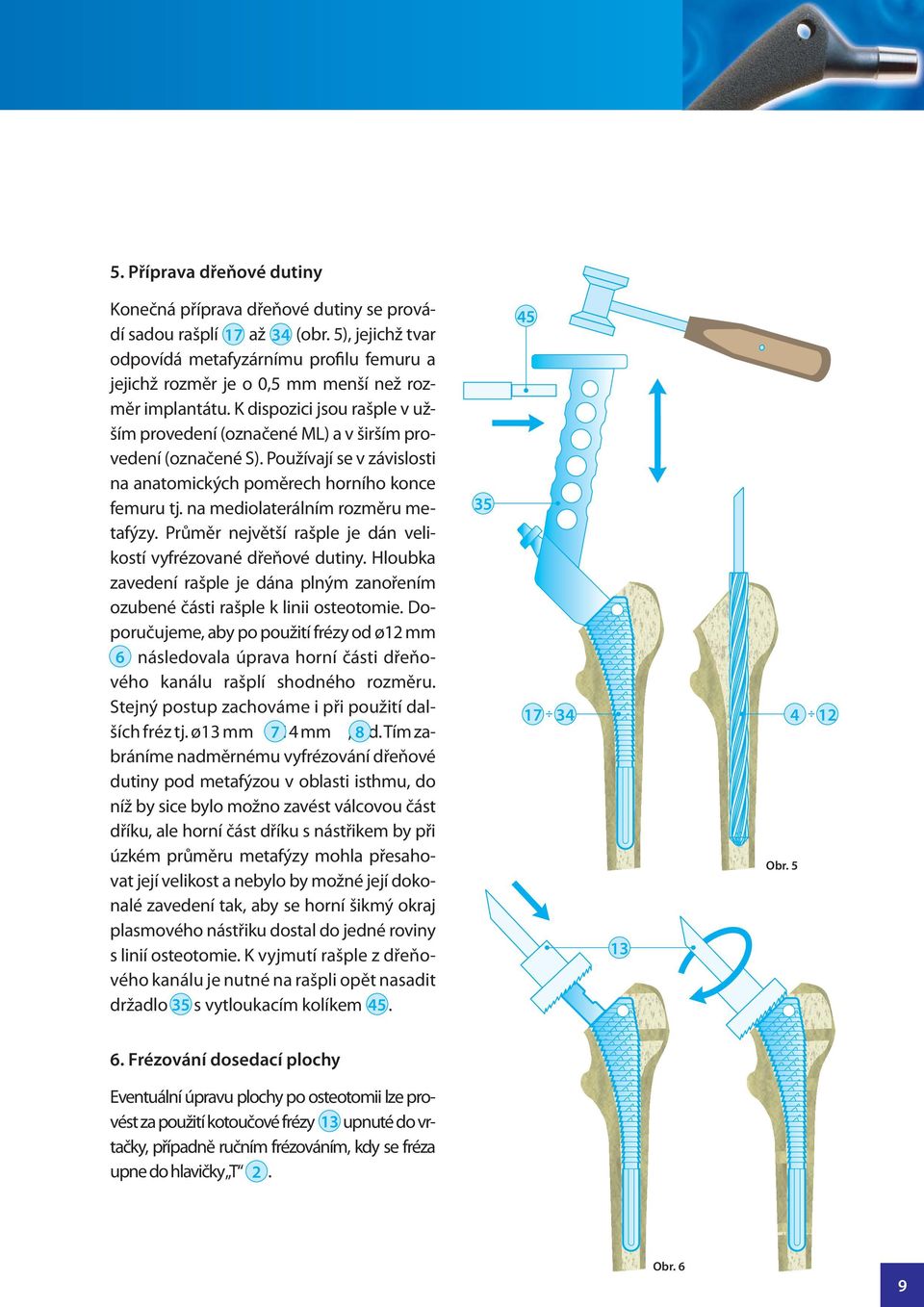 K dispozici jsou rašple v užším provedení (označené ML) a v širším provedení (označené S). Používají se v závislosti na anatomických poměrech horního konce femuru tj.