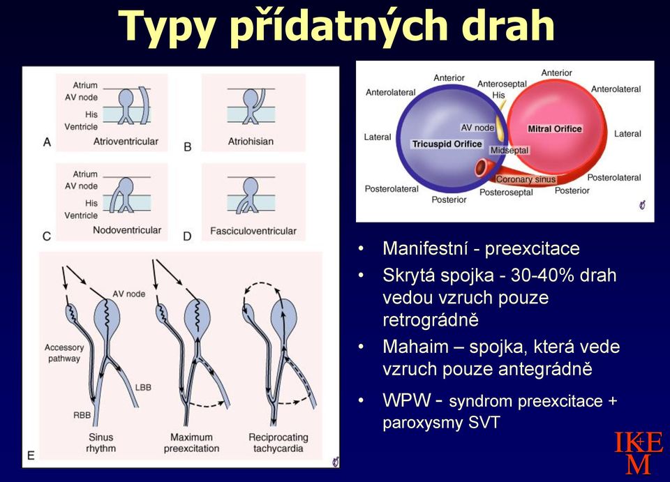 retrográdně ahaim spojka, která vede vzruch