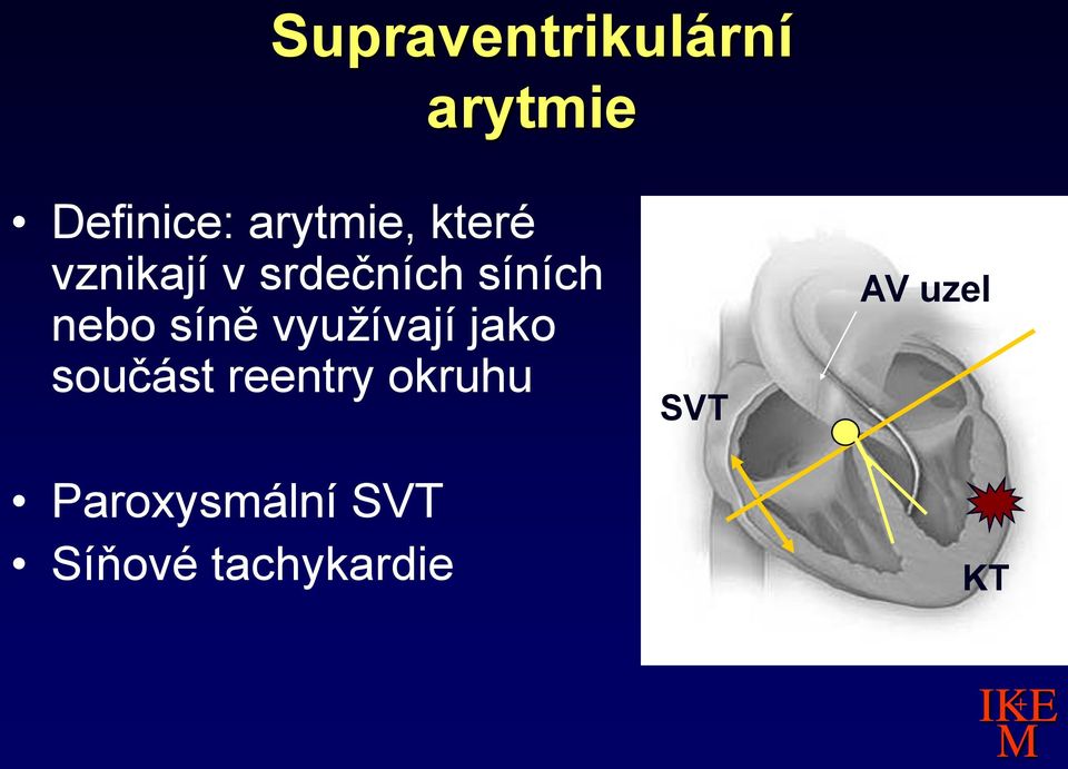 nebo síně využívají jako součást reentry