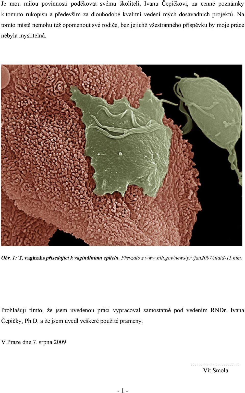 Obr. 1: T. vaginalis přisedající k vaginálnímu epitelu. Převzato z www.nih.gov/news/pr /jan2007/niaid-11.htm.