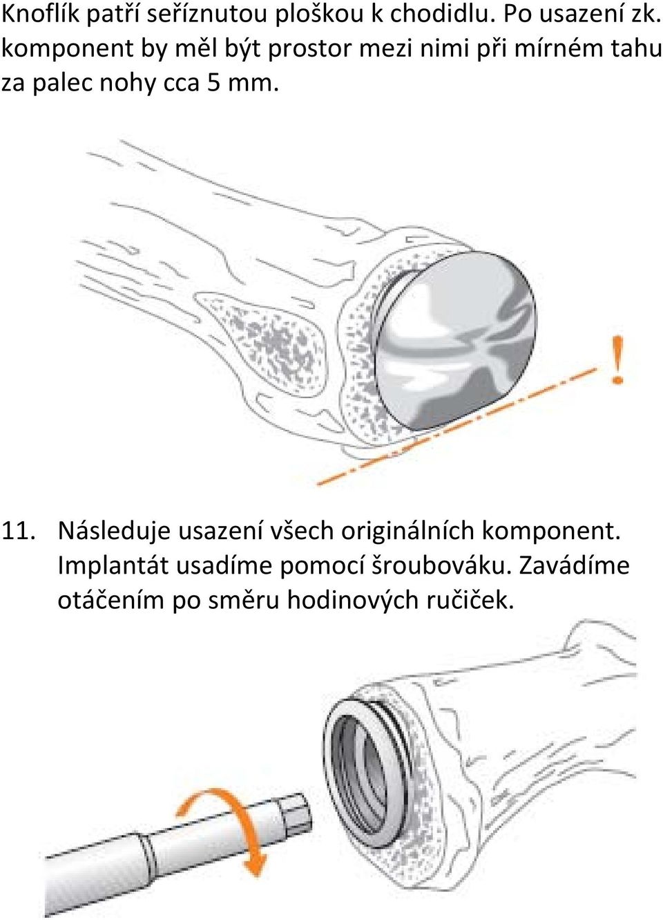 cca 5 mm. 11. Následuje usazení všech originálních komponent.